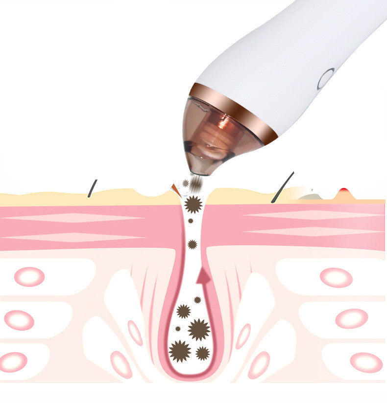 Máquina 4 en 1 para eliminar puntos negros con ventosas Guasha, limpieza profunda de poros faciales, belleza y cuidado de la piel