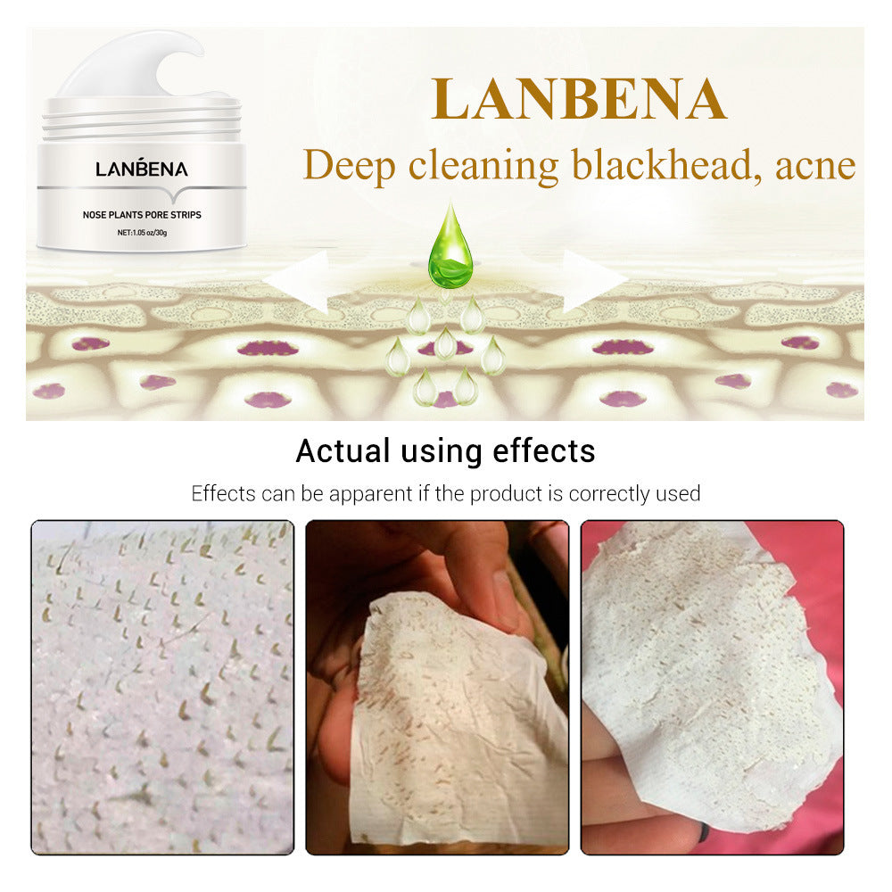 LANBENA Membrane nasale pour points noirs Aspiration des points noirs Déchirure pour éliminer l'acné