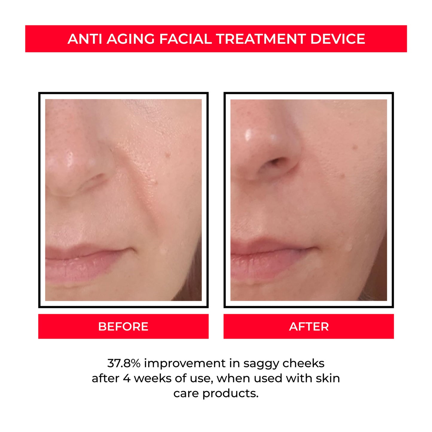 Anti-Aging Facial Treatment Device