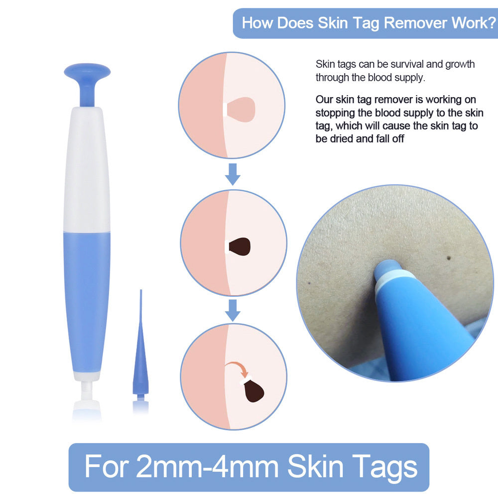 Kit de eliminación de verrugas cutáneas para uso doméstico, removedor de lunares y verrugas, tratamiento con microbandas para verrugas cutáneas.