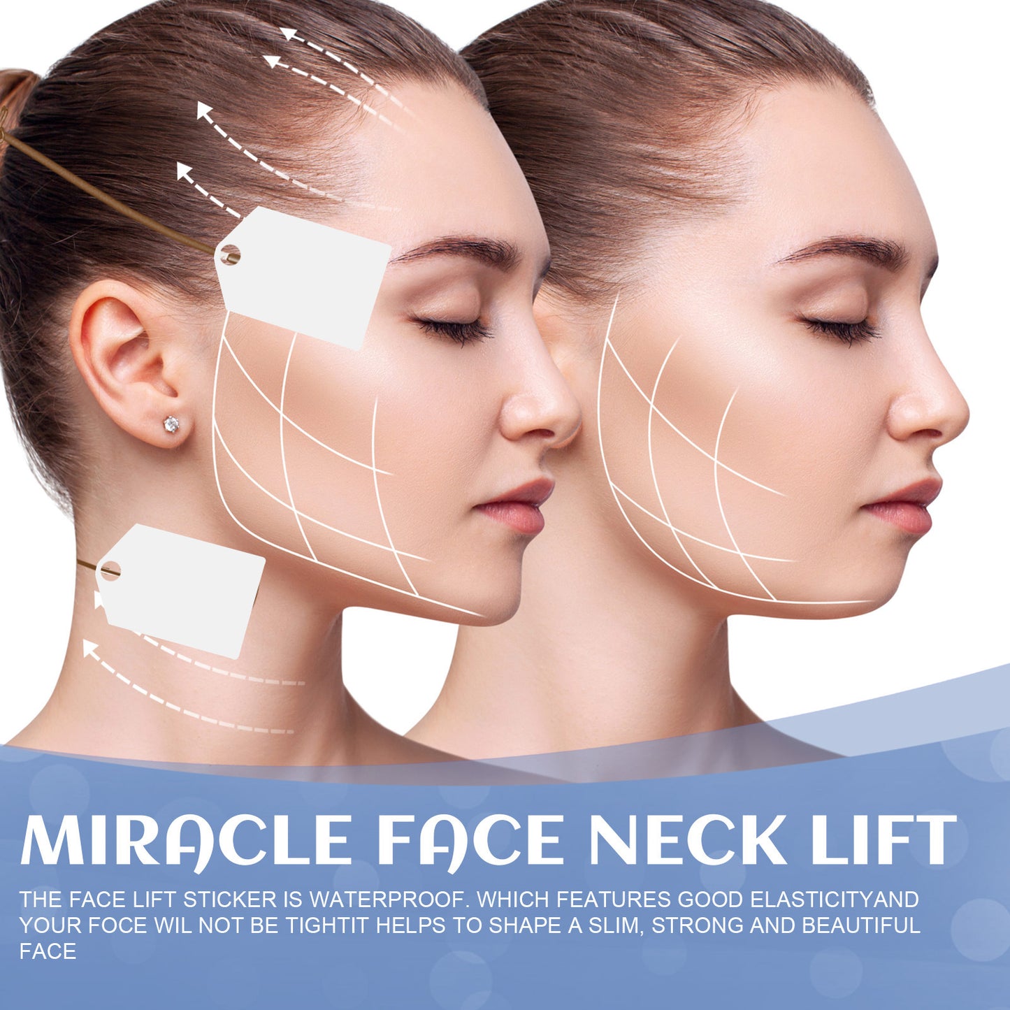 Lifting facial EELHOE con adhesivo de plástico en forma de V
