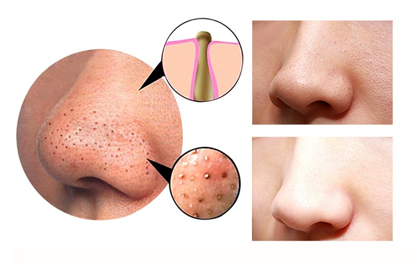 Appareil 4 en 1 pour éliminer les points noirs et les pores du visage, nettoyage en profondeur, beauté et soins de la peau