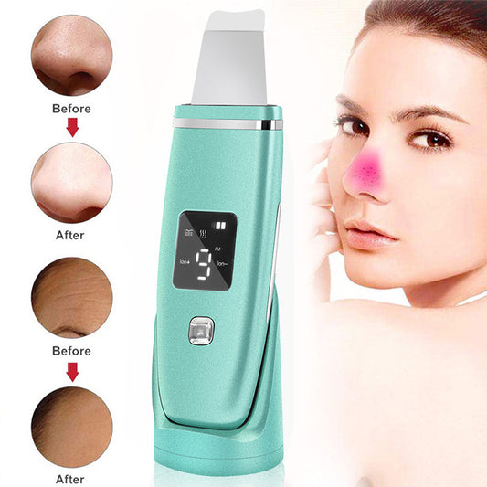 Éliminateur de points noirs par ultrasons, nettoyage en profondeur du visage, nettoyeur de pores, machine de levage, pelle à peeling LED pour le visage